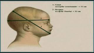 Présentations du front et bregma [upl. by Rue]