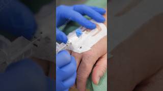 IV Catheter shortvideo [upl. by Acey103]