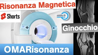 Risonanza Magnetica 🧲 del Ginocchio 2  Shorts menisco radiologia paziente 👇 [upl. by Wilow]