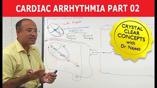 Cardiac Arrhythmia  Part 23 [upl. by Seugram]