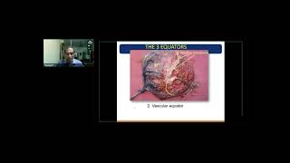 GE Webinar on Monochorionic Twins by Dr S Suresh [upl. by Alegnat]