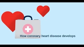 How coronary heart disease atherosclerosis develops  Bupa Health [upl. by Ahsa]