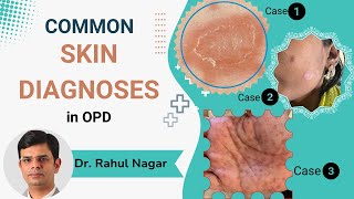 Common Skin Diagnoses In OPD [upl. by Kramer]