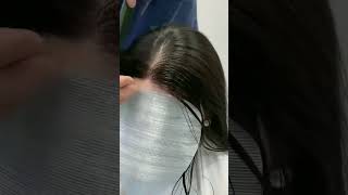 Receding hairline Dont miss this 🔥 Shop in description  Receding hairline patches [upl. by Remmos]