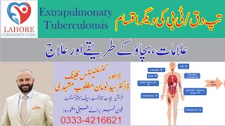 32 Extrapulmonary Tuberculosis TB  Types Prevention Treatment by Dr Syed Noman Mutloob [upl. by Roer168]