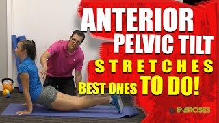 Anterior Pelvic Tilt Stretches BEST ONES TO DO [upl. by Lilahk796]