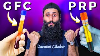 PRP vs GFC Treatment For Hair Growth  The Truth  Bearded Chokra [upl. by Enirac]