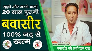 3 दिन में बवासीर Piles ठीक करें  piles treatment at home [upl. by Ylenats]