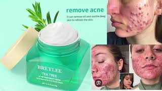 BREYLEE TEA TREE Acne TREATMENT CREAM [upl. by Ackler]