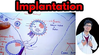 Implantation of BlastocystImplantation bleeding vs periodsImplantation symptoms in hindiurdu [upl. by Nolie454]