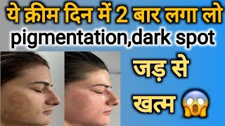 pigmentation dark spots amp काले धब्बें पहली बार में ही हटाओ l dark spots and pigmentation [upl. by Retsbew]