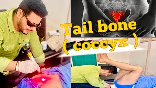 Tail Bone Adjustment by Chiropractor  Tailbone Pain Relief in sec  Coccydynia  Dr Aman Rasotra [upl. by Eruot]