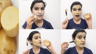 This Facial will Remove your Dark Spots amp pigmentation  आलू से कैसे करें फेशियल [upl. by Bardo]