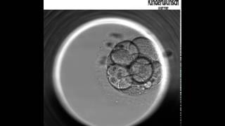 Die Embryo Entwicklung bis zur Blastozyste  Embryoskop [upl. by Irrej]