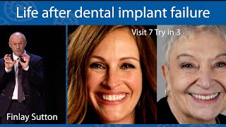 LIFE AFTER DENTAL IMPLANT FAILURE  a removable prosthodontic approach by Finlay Sutton at WDC 2023 [upl. by Isiah]