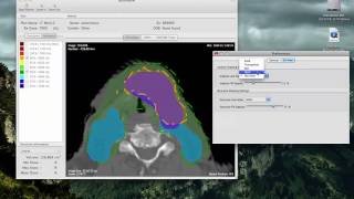 Preferences  Real time isodose display options [upl. by Ioyal224]