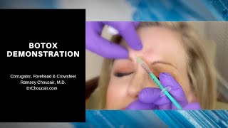 Botox® Demonstration Corrugators Forehead amp Crowsfeet  Ramsey Choucair MD  Ph 2143899797 [upl. by Wenonah484]