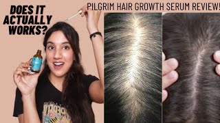 Pilgrim Redensyl amp Anagain Hair Serum For Hair Growth Review amp Results Does It Actually Works [upl. by Cecilia]