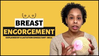 BREAST ENGORGEMENT Postpartum  Causes of Breast Engorgement Symptoms Effective Treatments [upl. by Sullecram]