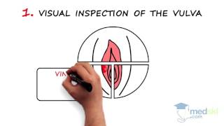 Obstetrics and Gynecology – Vaginal Discharge  Vulvar Pruritus By Kate Pulman MD [upl. by Waiter]