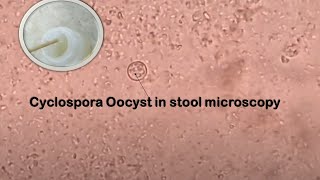 Cyclospora in Stool Microscopy [upl. by Sarad]