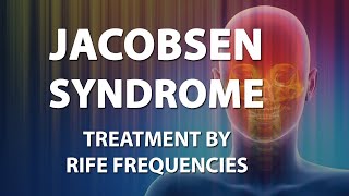 Jacobsen Syndrome  RIFE Frequencies Treatment  Energy amp Quantum Medicine with Bioresonance [upl. by Dubois]