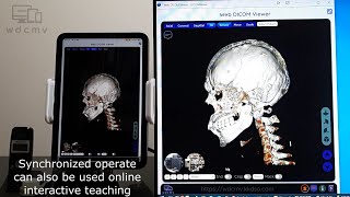 Start Medical Imagebased Teleconsultation using Web DICOM Viewer on iPad via Web Push Notification [upl. by Kaylil]