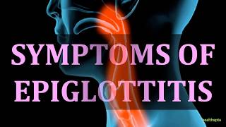 SYMPTOMS OF EPIGLOTTITIS [upl. by Levy]