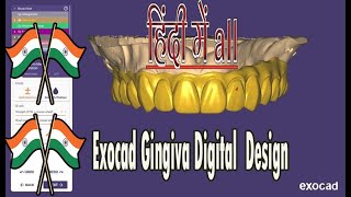 exocad gingiva design II exocad virtual gingiva design II how to add gingiva in exocad HINDI [upl. by Shela]