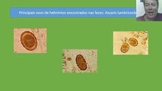 Técnicas laboratoriais II Aula 10 Atlas parasitológico Vídeo aula [upl. by Matthei995]