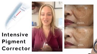 Clear MELASMA amp Hyperpigmentation with Sente Cyspera [upl. by Midge360]