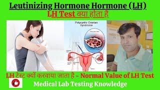 Luteinizing Hormone LH in Hindi  What is Luteinizing Hormone Test in Hindi  Normal Level of LH [upl. by Souvaine]