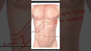 Kosher Subcostal incision anatomy learnanatomy [upl. by Gassman]