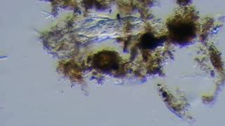 Rotifer 231120131031 [upl. by Aiela]