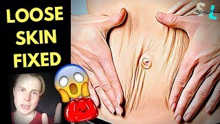 LOOSE SKIN HELP 😱 How to Lose Loose Skin After Weight Loss [upl. by Hahseram]