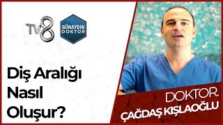 Diş Aralığı Nasıl Kapanır Sebepleri Nelerdir  DR Çağdaş KIŞLAOĞLU [upl. by Neladgam542]