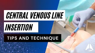 Central Venous Catheter CVC Demonstration  anesthesiology anesthesia anaesthesia cvc [upl. by Kantor]