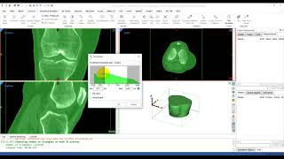 How to Perform Thresholding in Mimics  Mimics Innovation Suite  Materialise Medical [upl. by Mapes701]