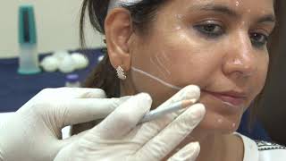 Complete video training on Botulinum Injections for face and Neck [upl. by Aerdnat879]