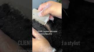 Flaky Scalp Removal On Natural Hair [upl. by Hodgkinson348]