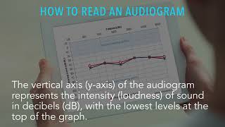 Understanding your audiogram [upl. by Solana792]