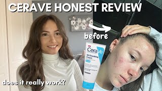 TESTING CERAVE FOR A MONTH SA SMOOTHING CREAM for TEXTURED SKIN [upl. by Winne]