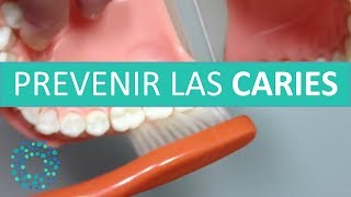 Reconstruccion diente con caries [upl. by Ajaj]