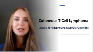 Criteria to Diagnose Mycosis Fungoides Chapter 1 [upl. by Ehcropal149]