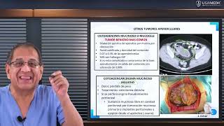 RM 2024 Cirugía 5 Tumores de Apéndice carcinoide mucocele [upl. by Akela]