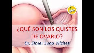 TE ENSEÑO 🔥 ¿Qué son los QUISTES DE OVARIO 🧘 y CÓMO TRATARLOS  Dr Elmer Luna Vilchez [upl. by Whalen494]