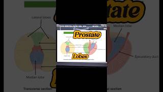 Prostate Ultrasound  Enlarged Prostate  BPH  Median Lobe Prostate  Prostatomegaly on Usg [upl. by Werby]