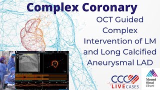 OCT Guided Complex Intervention of LM and Long Calcified Aneurysmal LAD [upl. by Figone439]