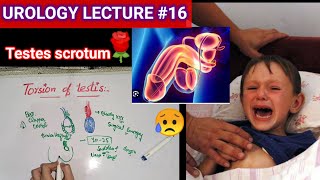 Urology surgery lecture 16 torsion of testis testicular appendages orchitis [upl. by Samson]