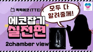 심장초음파 실전 Apical 2chamber view 잡기 echocardiography 심장초음파 echo sonography cardiology [upl. by Trebor]